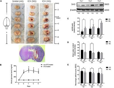 Sirt3 Ameliorates Oxidative Stress and Mitochondrial Dysfunction After Intracerebral Hemorrhage in Diabetic Rats